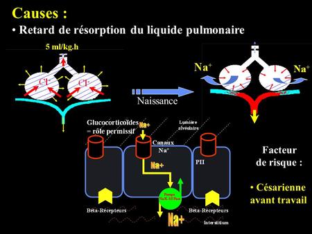 Causes : Retard de résorption du liquide pulmonaire Naissance Facteur