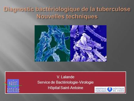 Diagnostic bactériologique de la tuberculose Nouvelles techniques