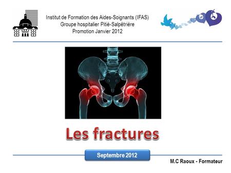 Les fractures Septembre 2012