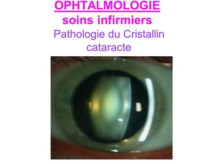 OPHTALMOLOGIE soins infirmiers