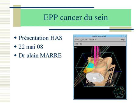 EPP cancer du sein Présentation HAS 22 mai 08 Dr alain MARRE.