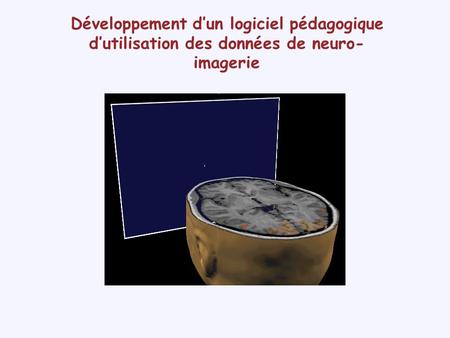 Développement d’un logiciel pédagogique d’utilisation des images cérébrales