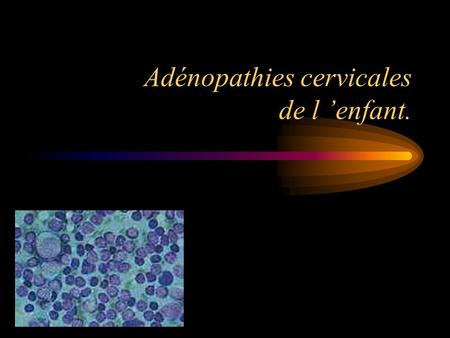 Adénopathies cervicales de l ’enfant.