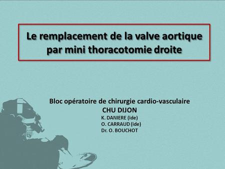 Le remplacement de la valve aortique par mini thoracotomie droite