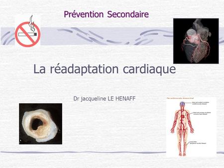 La réadaptation cardiaque Dr jacqueline LE HENAFF