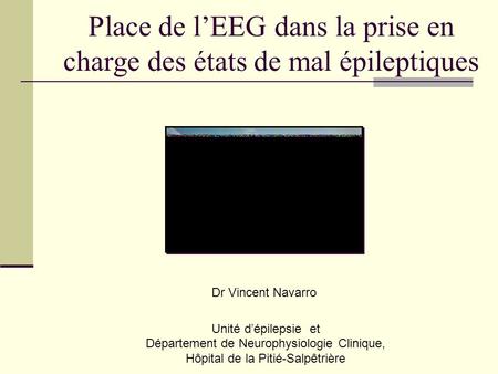Place de l’EEG dans la prise en charge des états de mal épileptiques