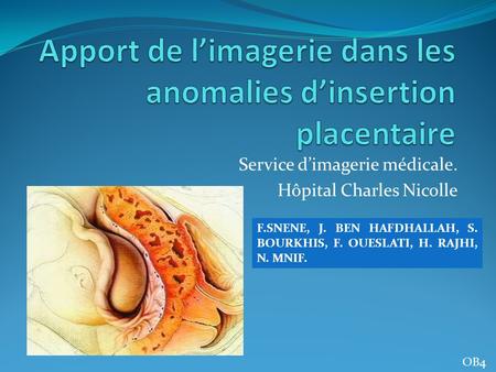 Apport de l’imagerie dans les anomalies d’insertion placentaire