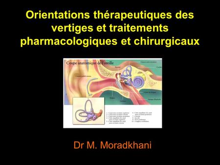 Orientations thérapeutiques des vertiges et traitements pharmacologiques et chirurgicaux Dr M. Moradkhani.