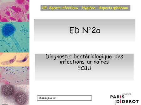 Diagnostic bactériologique des infections urinaires ECBU