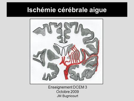 Ischémie cérébrale aigue Enseignement DCEM 3 Octobre 2009 JM Bugnicourt.