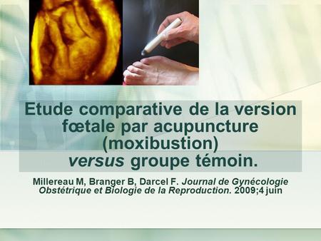 Etude comparative de la version fœtale par acupuncture (moxibustion) versus groupe témoin. Millereau M, Branger B, Darcel F. Journal de Gynécologie Obstétrique.