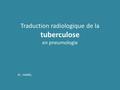 Traduction radiologique de la tuberculose en pneumologie