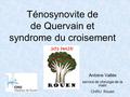 Ténosynovite de de Quervain et syndrome du croisement