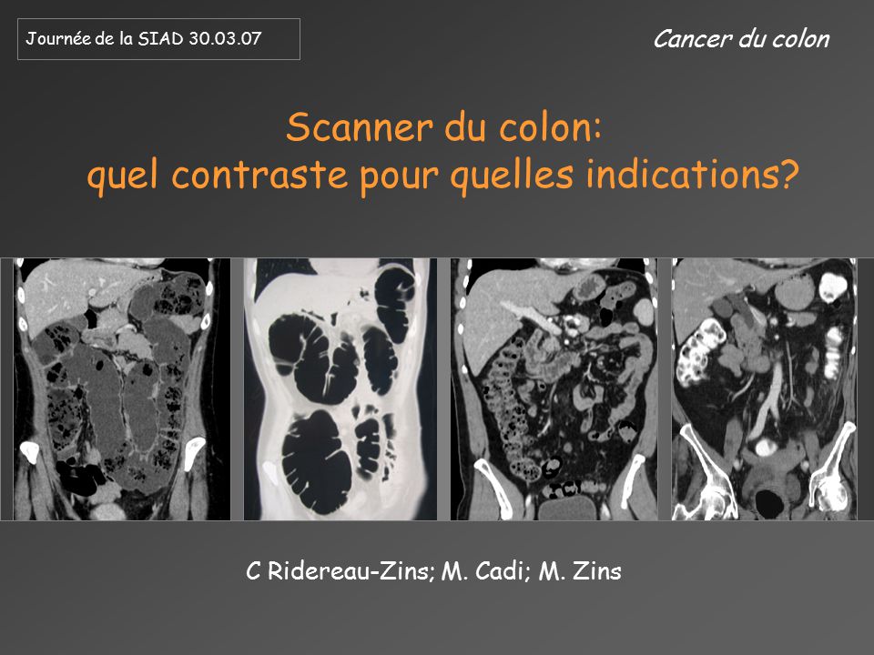 Scanner du colon: quel contraste pour quelles indications?