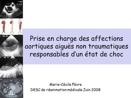 Marie-Cécile Fèvre DESC de réanimation médicale Juin 2008