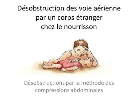Désobstruction des voie aérienne par un corps étranger chez le nourrisson Désobstructions par la méthode des compressions abdominales.
