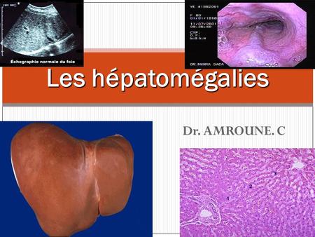 Dr. AMROUNE. C Les hépatomégalies. Introduction :  Définition  Définition  Intérêt  Intérêt  Rappels anatomophysiologiques  Rappels anatomophysiologiques.