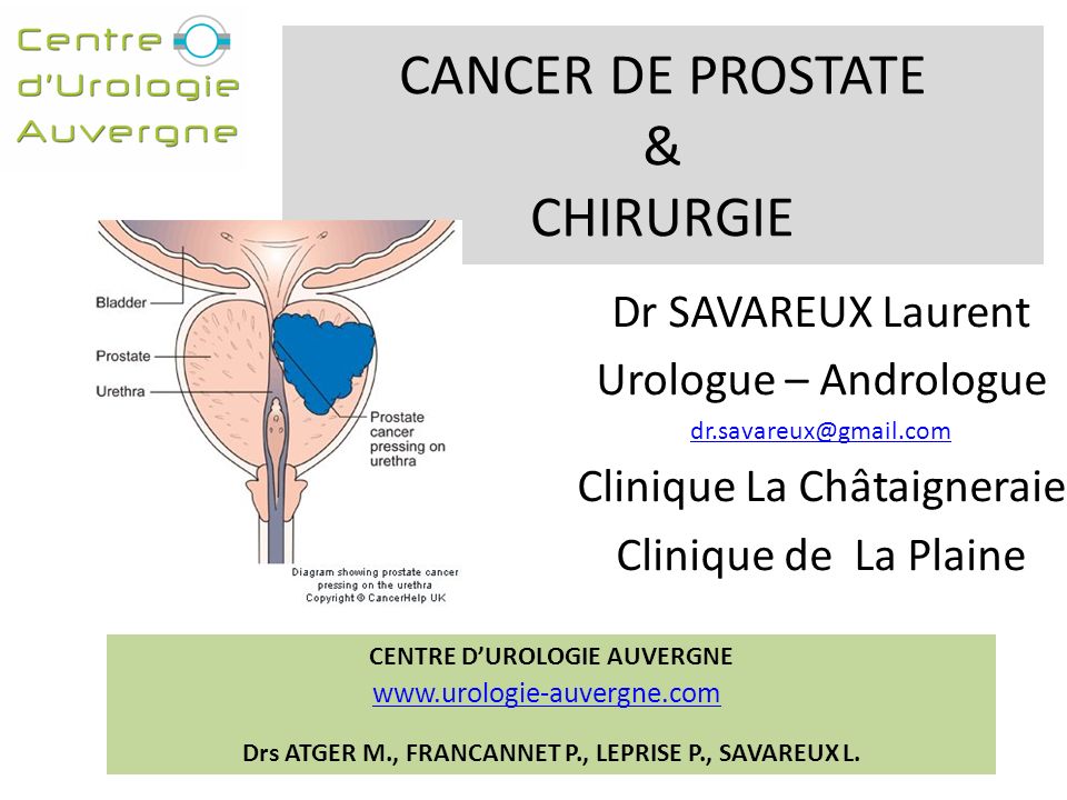 CANCER DE PROSTATE & CHIRURGIE - ppt télécharger