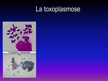 La toxoplasmose.