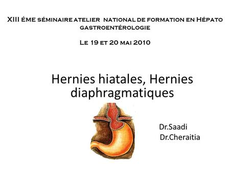 Hernies hiatales, Hernies diaphragmatiques Dr.Saadi Dr.Cheraitia