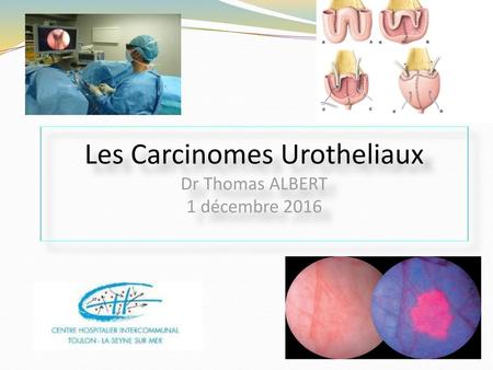 Les Carcinomes Urotheliaux