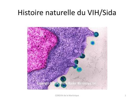 Histoire naturelle du VIH/Sida