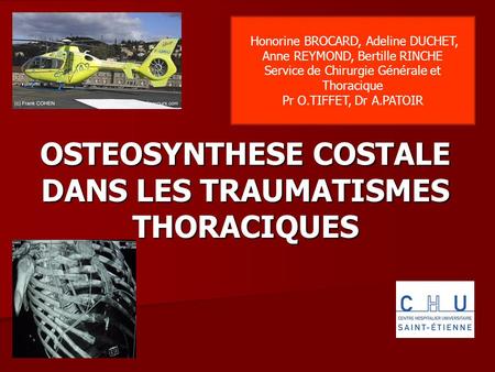 OSTEOSYNTHESE COSTALE DANS LES TRAUMATISMES THORACIQUES