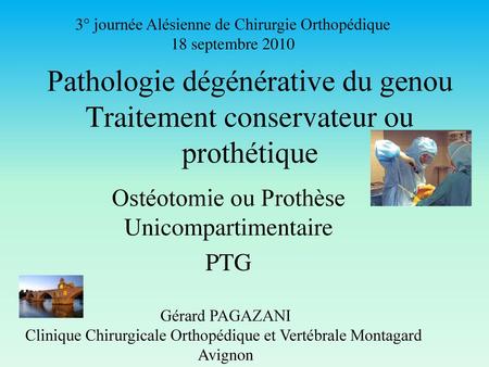Ostéotomie ou Prothèse Unicompartimentaire PTG