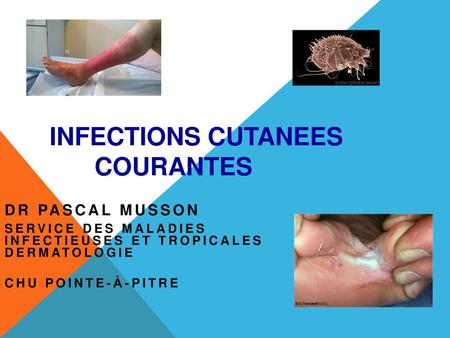 INFECTIONS CUTANEES COURANTES