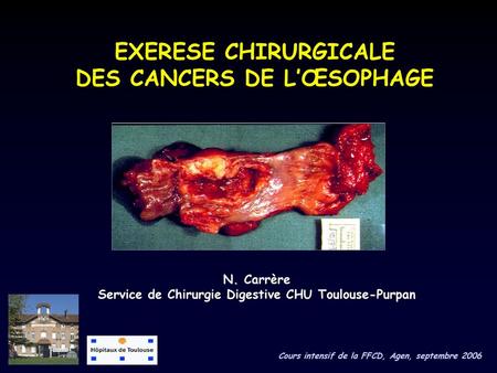 EXERESE CHIRURGICALE DES CANCERS DE L’ŒSOPHAGE