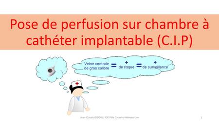 Pose de perfusion sur chambre à cathéter implantable (C.I.P)