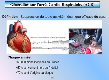 Généralités sur l’arrêt Cardio-Respiratoire (ACR)