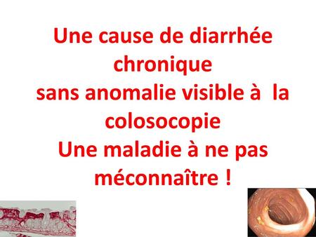 Une cause de diarrhée chronique sans anomalie visible à la colosocopie Une maladie à ne pas méconnaître !