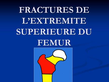 FRACTURES DE L’EXTREMITE SUPERIEURE DU FEMUR