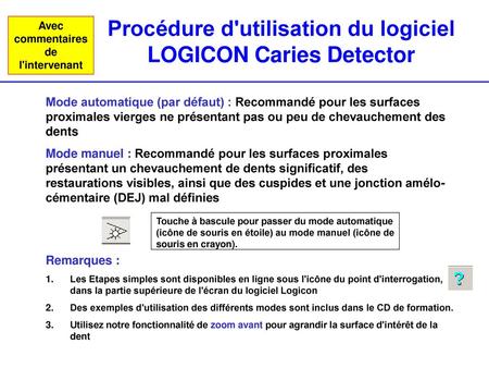 Procédure d'utilisation du logiciel LOGICON Caries Detector