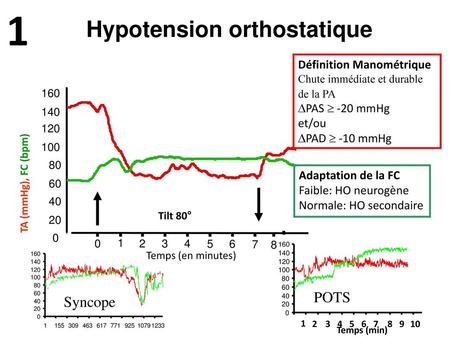 1 Hypotension orthostatique POTS Syncope Définition Manométrique