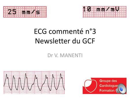 ECG commenté n°3 Newsletter du GCF