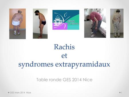 Rachis et syndromes extrapyramidaux