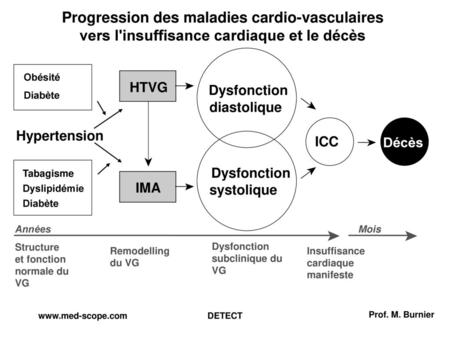 Progression des maladies cardio-vasculaires