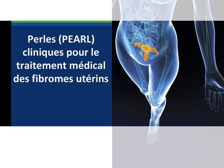 Perles (PEARL) cliniques pour le traitement medical des fibromes utérins