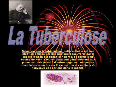 La Tuberculose Qu’est-ce que la tuberculose: cette maladie est une infection causée par une bactérie découverte par le médecin koch qui donna son nom à.