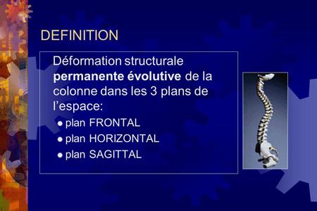 DEFINITION Déformation structurale permanente évolutive de la colonne dans les 3 plans de l’espace: plan FRONTAL plan HORIZONTAL plan SAGITTAL.
