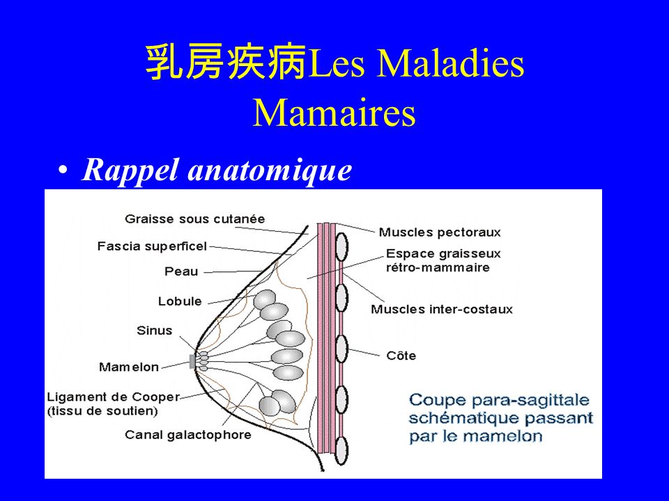 乳房疾病Les Maladies Mamaires - ppt télécharger
