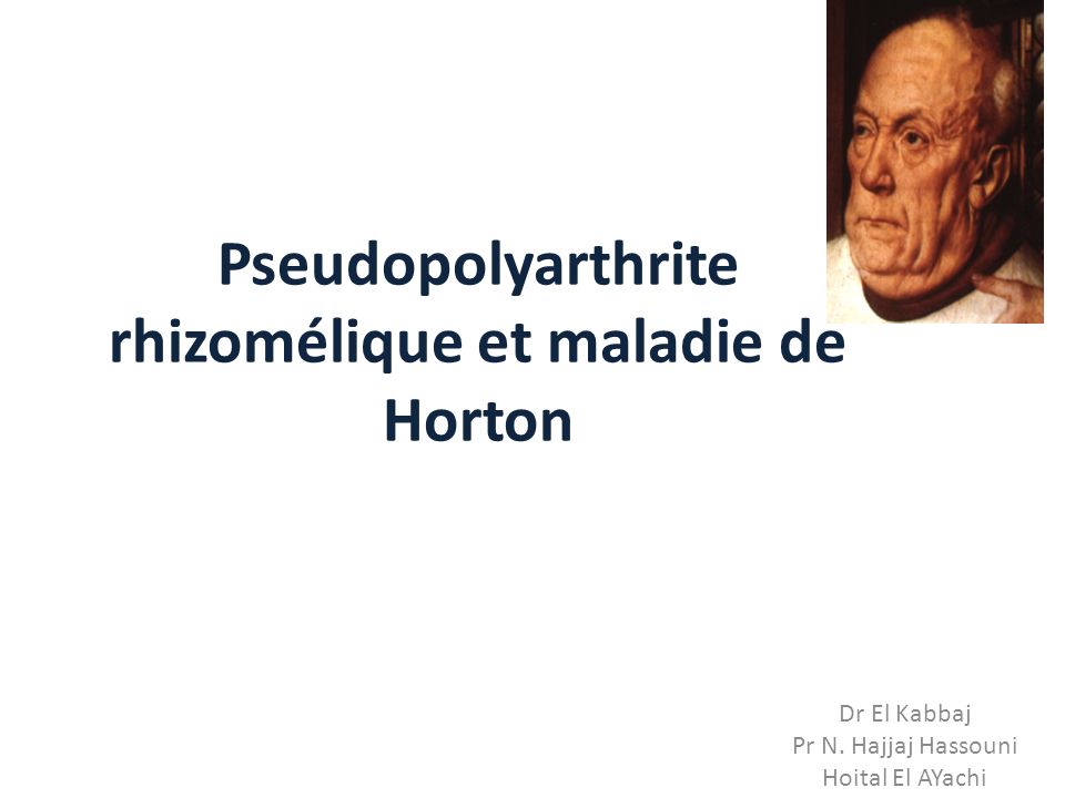 Pseudopolyarthrite Rhizomélique Et Maladie De Horton Ppt Télécharger