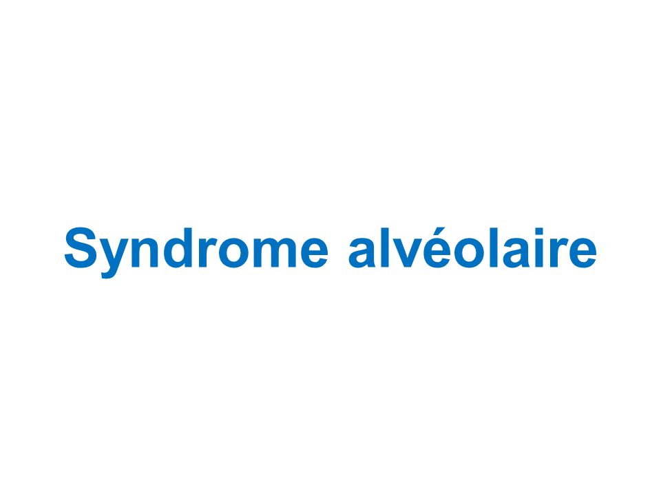 Syndrome alvéolaire