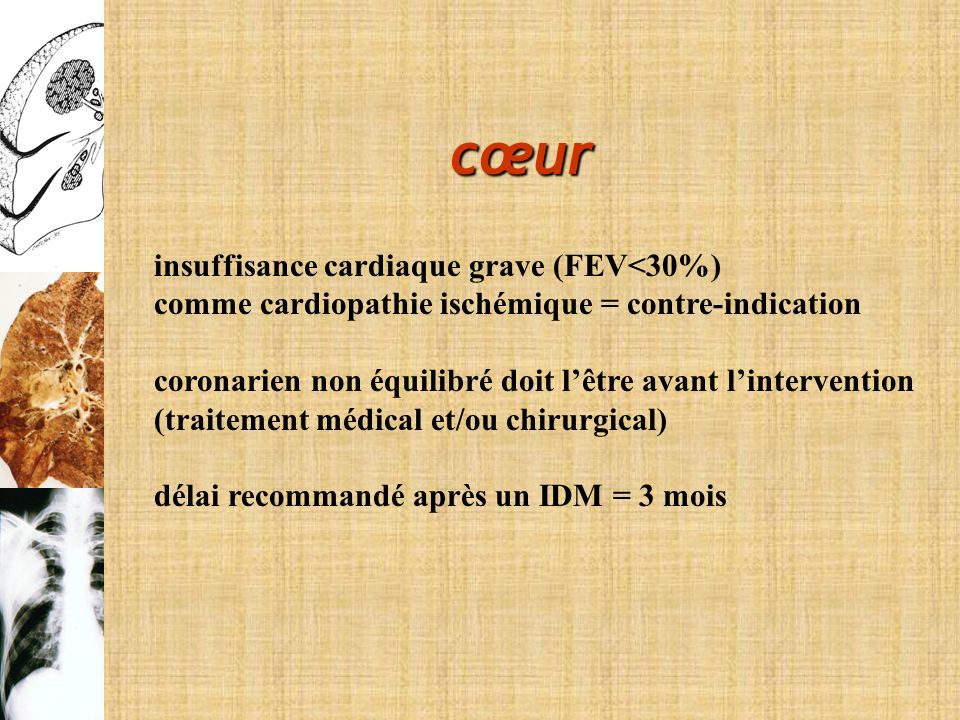 cœur insuffisance cardiaque grave (FEV<30%)