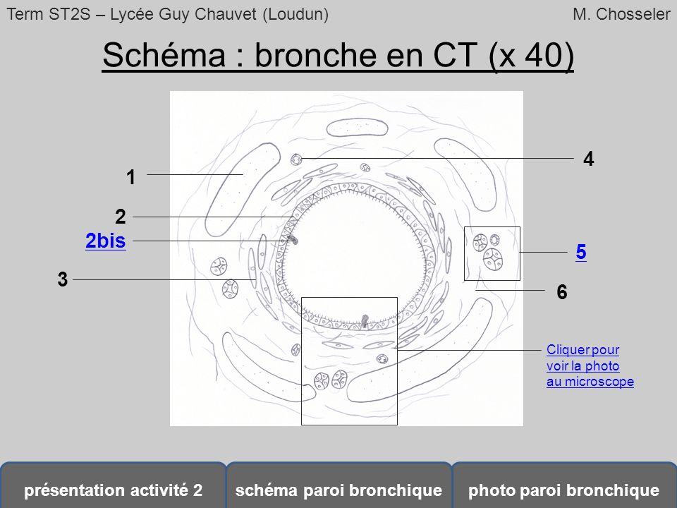 Schéma : bronche en CT (x 40)