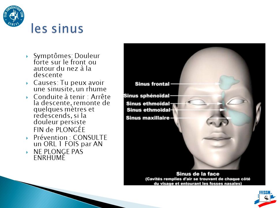les sinus Symptômes: Douleur forte sur le front ou autour du nez à la descente. Causes: Tu peux avoir une sinusite, un rhume.