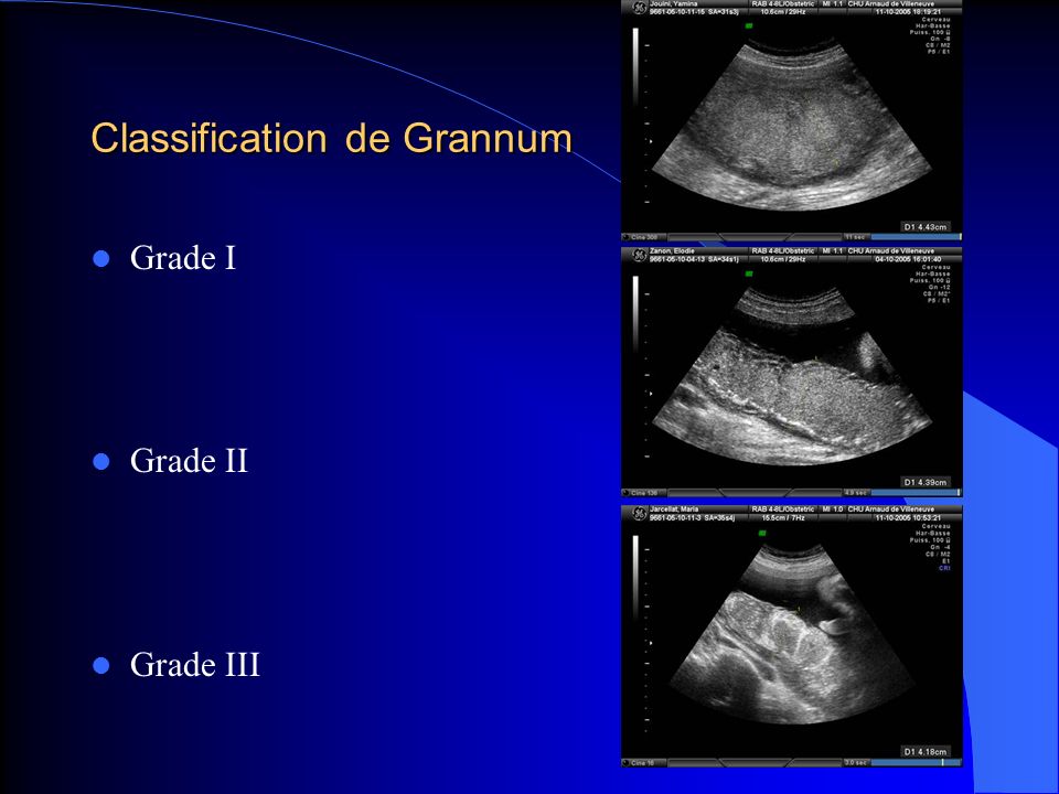 Classification de Grannum