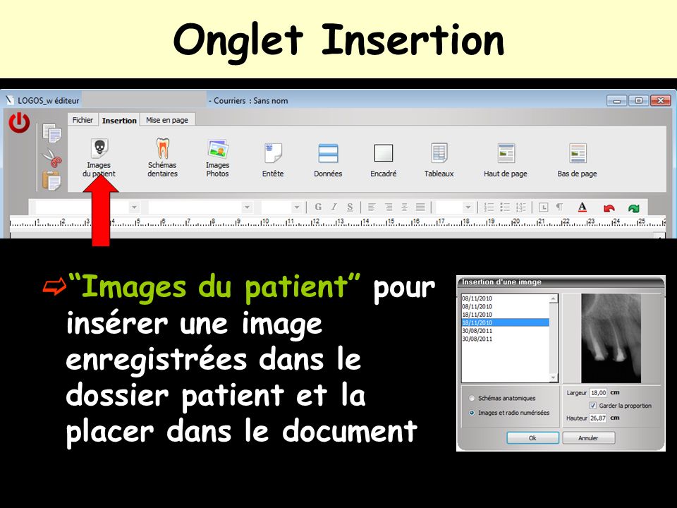 Onglet Insertion Images du patient pour insérer une image enregistrées dans le dossier patient et la placer dans le document.